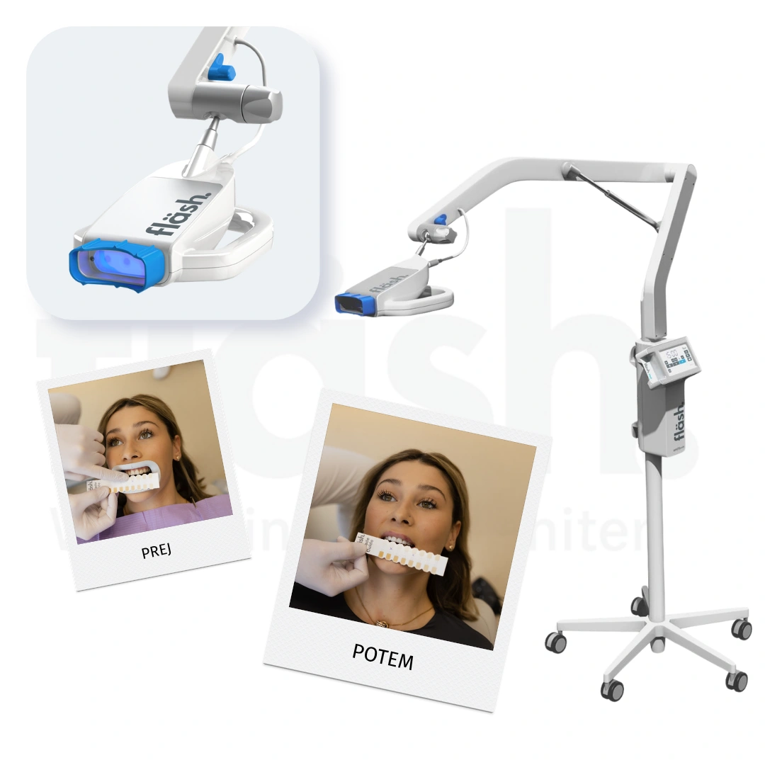 flash whitening lamp OrthoM ortodontija